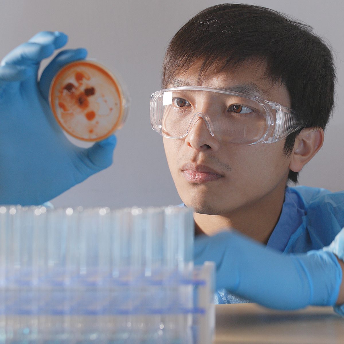 Scientist doing research on bacterial colonies in an opened glass petri dish