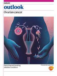 Nature Outlook on Ovarian Cancer