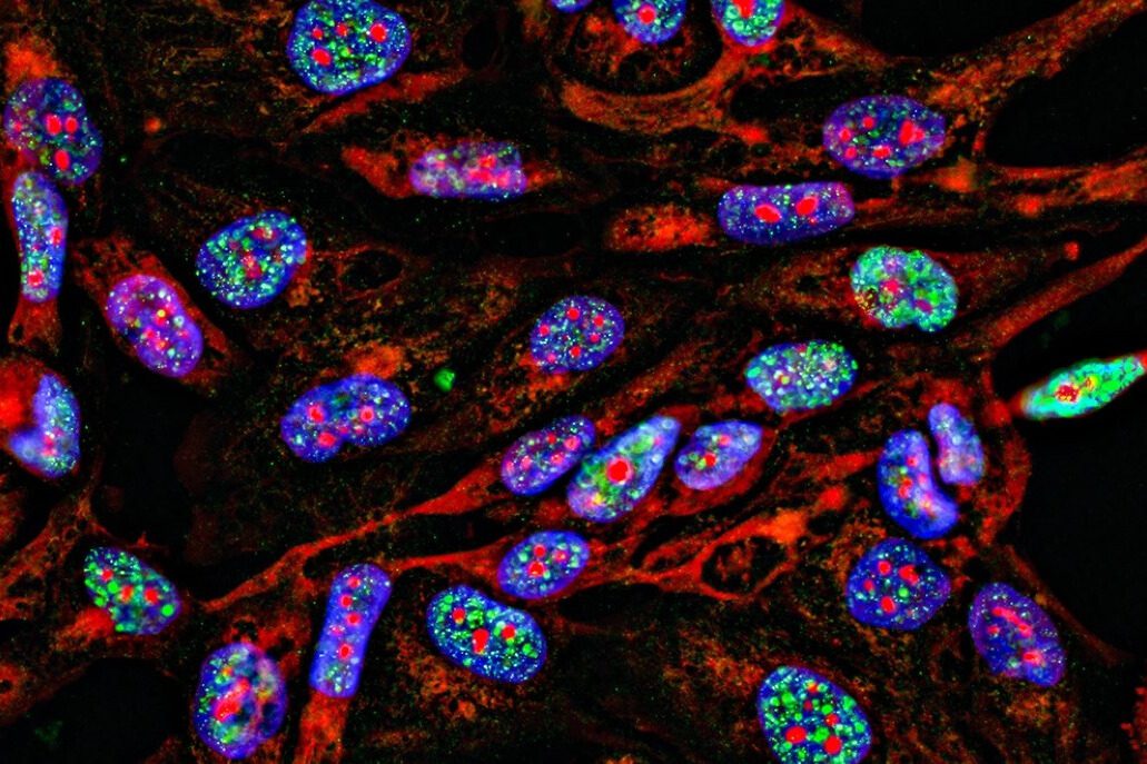 Billion-Dollar Boost: Trends in Oncology Research and Development